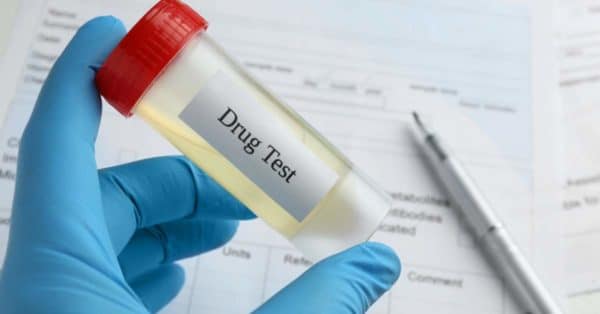 Dear Roadie: Should I Drug-Test My Son to Ensure He’s Not Wasting His College Tuition?